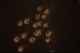 Mexill&oacute;n ao microscopio (CSIC)