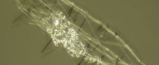 Tard&iacute;grado. Detalle dos sistemas neuronais e musculares. Polarizaci&oacute;n (400x)